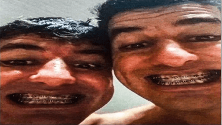 teste marca carregamento de imagem