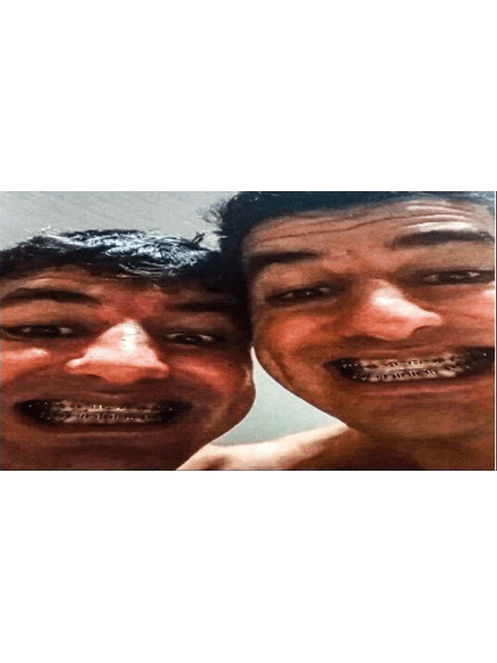 teste marca carregamento de imagem