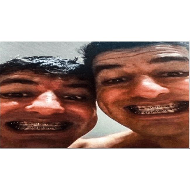 teste marca carregamento de imagem